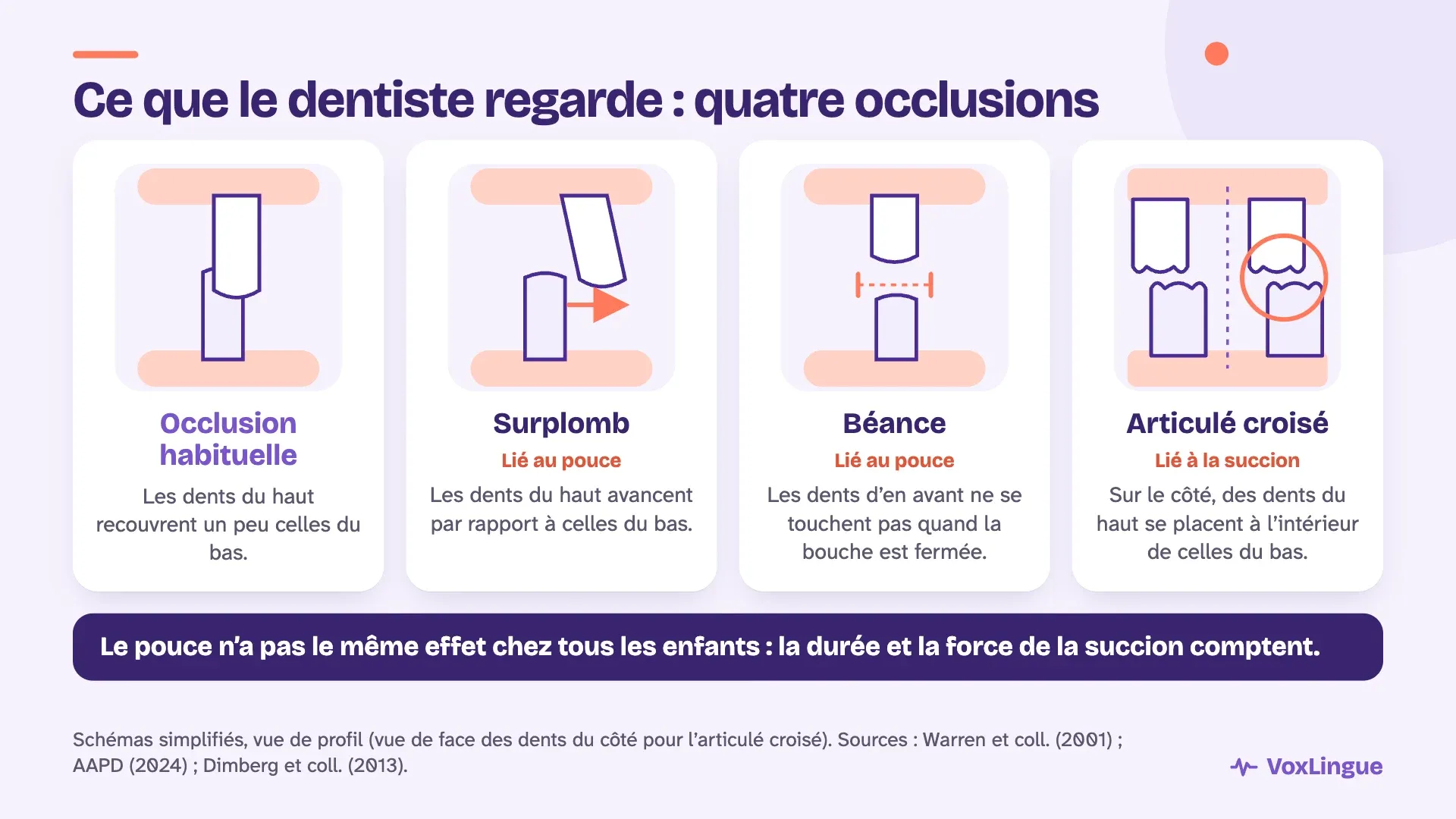 Schémas de quatre occlusions : l’occlusion habituelle, le surplomb et la béance liés au pouce, et l’articulé croisé lié à la succion